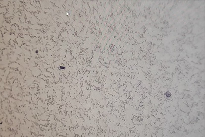 การตรวจจับโลหะ-500เท่าของโลหะวิทยา